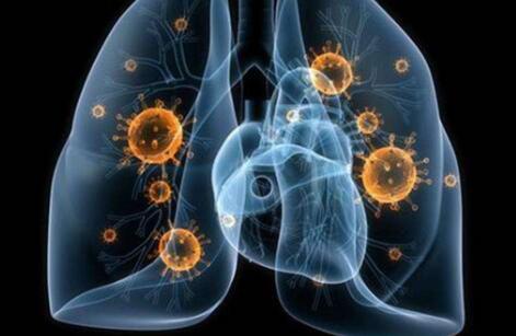 三个征兆说明已有肺炎，尤其第一个最明显，大家需注意